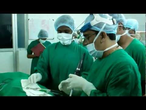 Microdebrider Sinus Surgery in India.