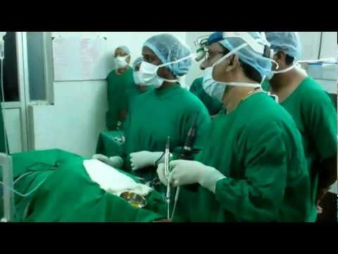 Microdebrider Sinus Surgery in Trvandrum India