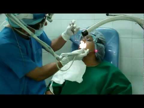 Nasal Allergy:Laser Treatment
