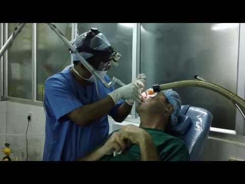 Nasal Discharge Treated By Laser