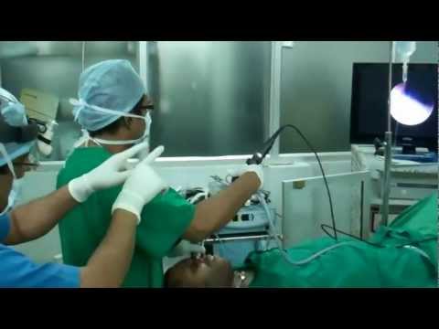 Neck Injury:Subglottic Stenosis