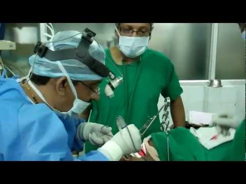 Negative Pressure Pulmonary Edema after Sleep Apnea Surgery