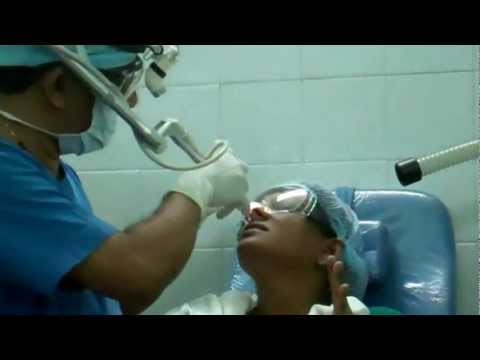 Nose Blocked-Can’t Breathe? Get Laser Cautery