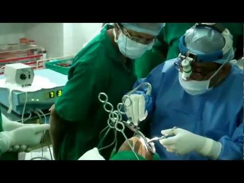 Pain Less Tonsillectomy in Children