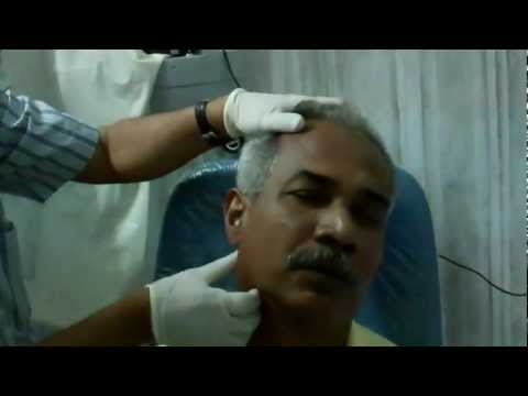 Parotid Gland Tumor Surgery:Pre Op Evaluation