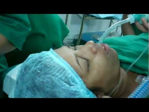 Putting a Patient into Sleep:General Anesthesia