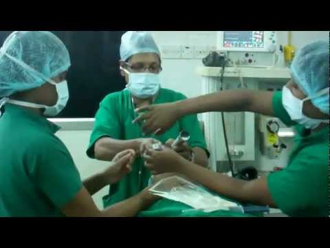 Putting Karthik into Sleep: Anesthesia for Laser Surgery of Nose