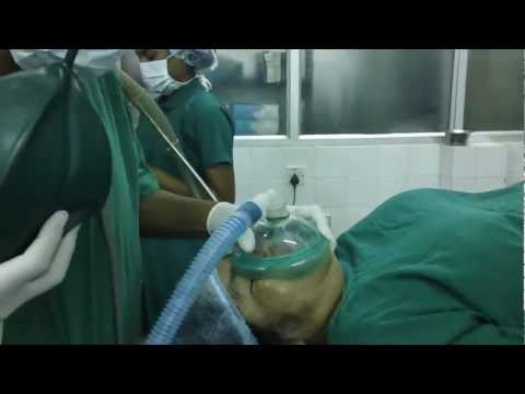 Putting Mrs.Padma to Sleep:Anesthesia Intubation