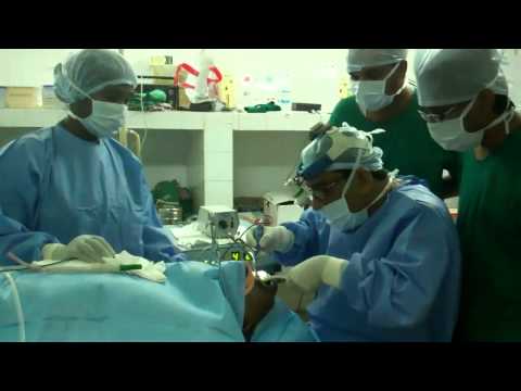 RF Channeling for Snoring and Sleep Apnea