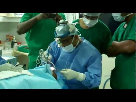 RF Surgery for snoring and OSA in Trivandrum