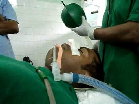 Rhinoplasty-Anesthesia.AVI