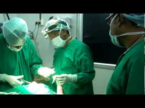 Rhinoplasty:Anesthesia Issues