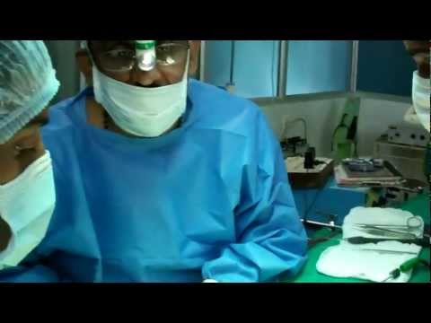 Rhinoplasty In India:A Tribute to Sushrutha
