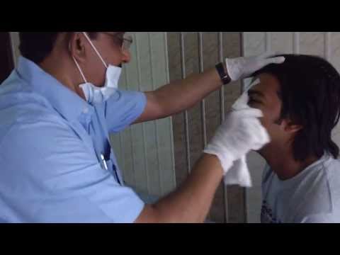 Rhinoplasty in India-Removing Nasal Pack
