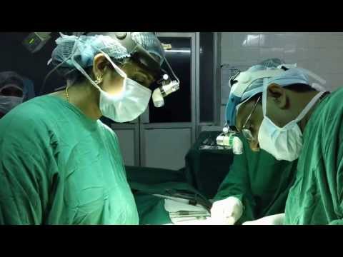 Rhinoplasty in Thick Bulbous Nose