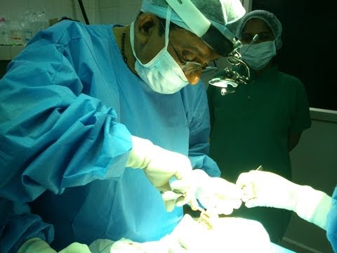 Rhinoplasty-Making Nose Longer