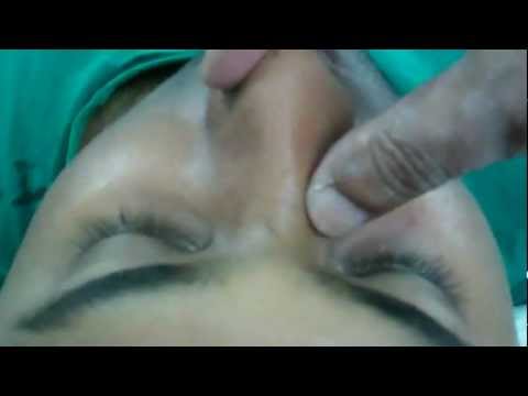 Rhinoplasty:Making surgical planning