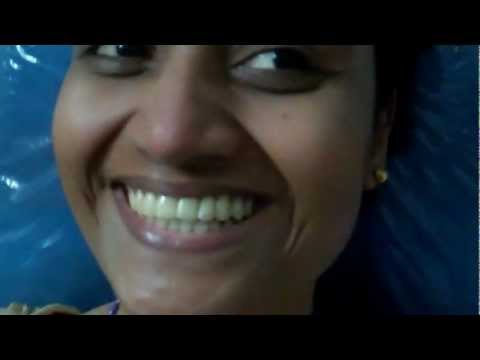 Septoplasty in Childhood:After effects