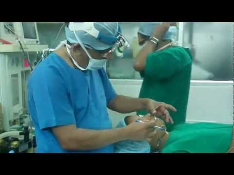 Septoplasty in Children:Preop Planning