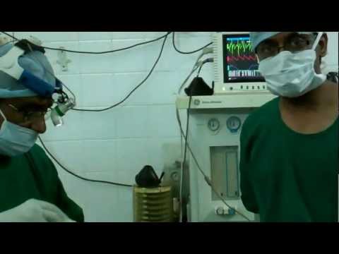 Septoplasty-Post Op Care