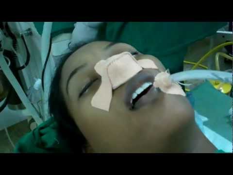 Septoplasty:Post Operative Care