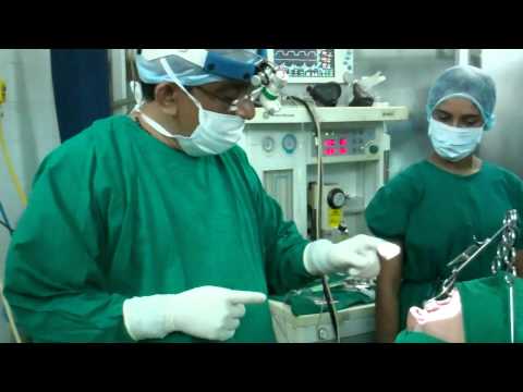 Sleep Disoder:Snoring and Sleep Apnea:Surgical Treatment