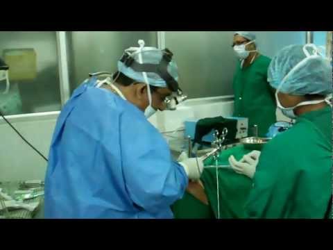 Sleep Disorder Breathing:Surgical Treatment