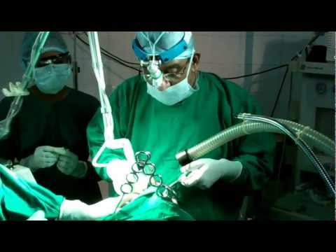 Snoring and Sleep apnea Can Ruin Your Marriage and Sex Life:Get Treated