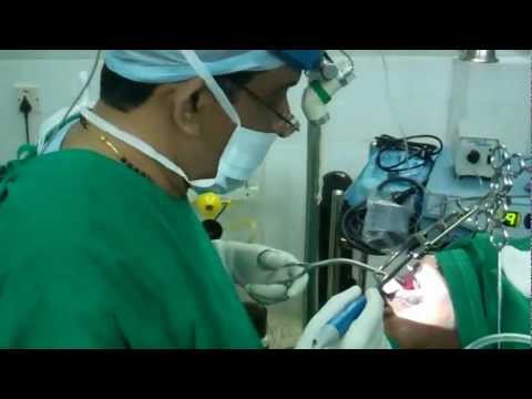 Snoring and Sleep Apnea:Complications