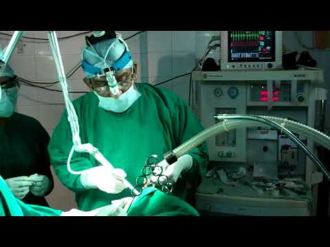 Snoring And Sleep Apnea: Is It Familial?