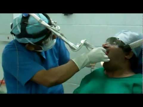 Snoring and Sleep apnea:Laser Surgical Treatment