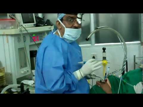 Snoring and Sleep Apnea Surgery:Any Risk?