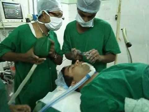 Snoring and Sleep Apnea Surgery-GA-Intubation.AVI
