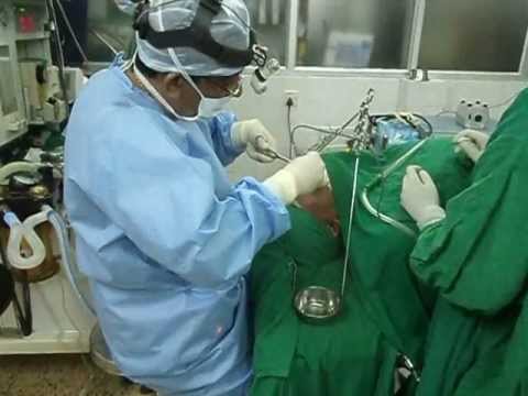 Snoring and Sleep Apnea:Work Up