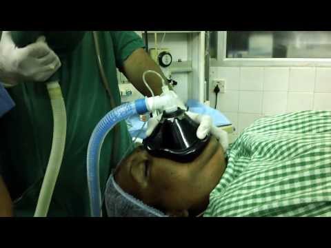 Snoring in Women:Drug Induced Sleep (Somno) Endoscopy