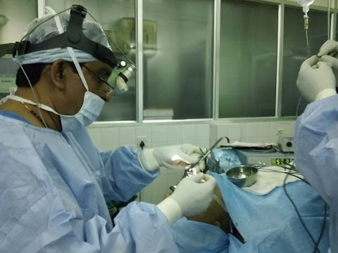 Snoring Surgery Trivandrum India-Distance doesn’t matter