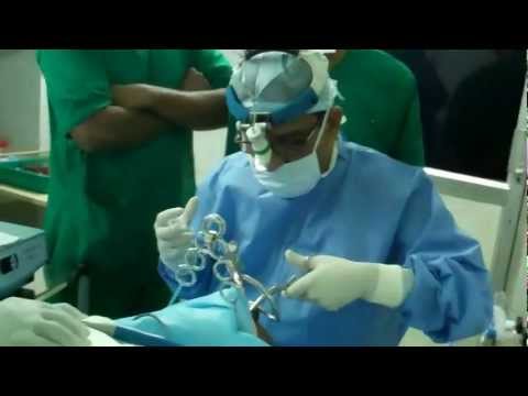 Snoring treatment for poor in India?