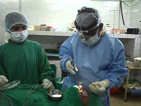 Snoring Treatment:Surgical Options