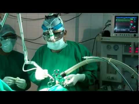 Stop Snore, Sleep well and Save your Marriage.