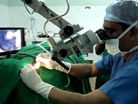 Surgery for Deafness