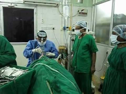 Surgical Option in Treating Snoring and Sleep Apnea