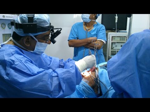 Surgical Options to Beat Sleep Apnea (India)