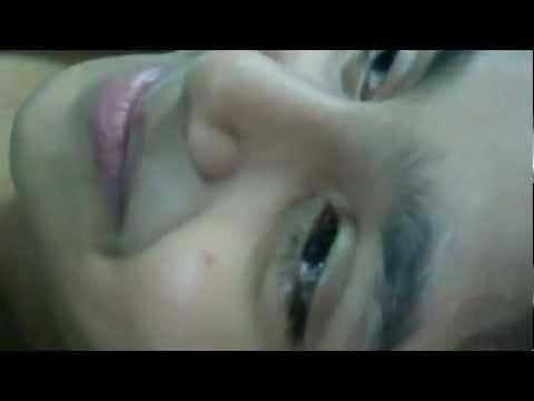 Sweet Girl Jasmine is ready for Surgery