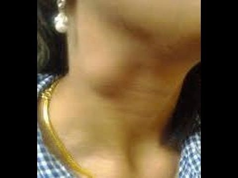 Swollen Lymph Node in the Neck: Excision Biospy