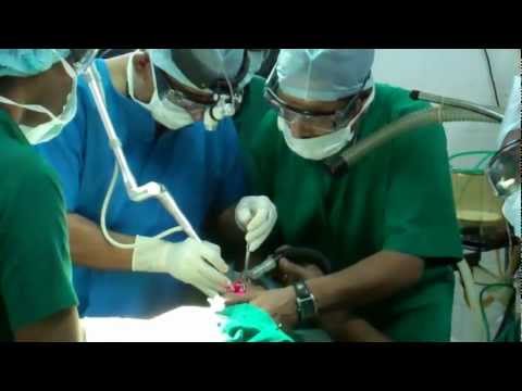 Tongue Tie Operation In Children By Laser