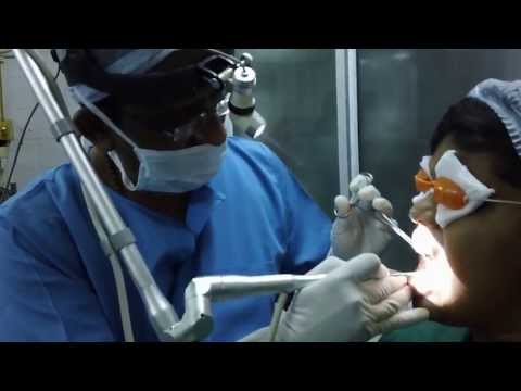 Tongue Tie Release by Laser in a Teenager