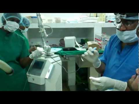 Tongue Tie: RF (Coblator) Surgery in Trivandrum