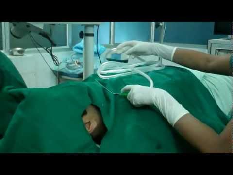 Treating Ear Ache After Flying:Pre Op evaluation