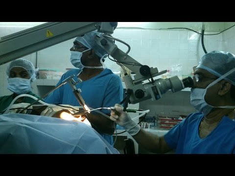 Voice Abuse and Vocal Nodule-Microdebrider Surgical Removal